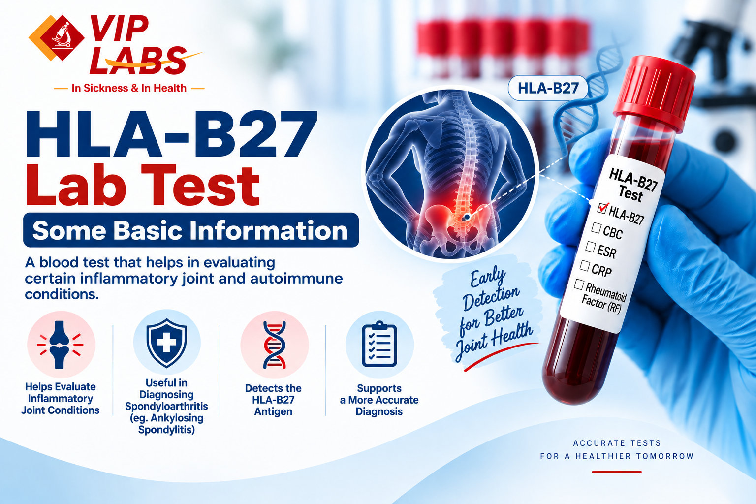 Some Basic Information about HLA B27 Lab Test