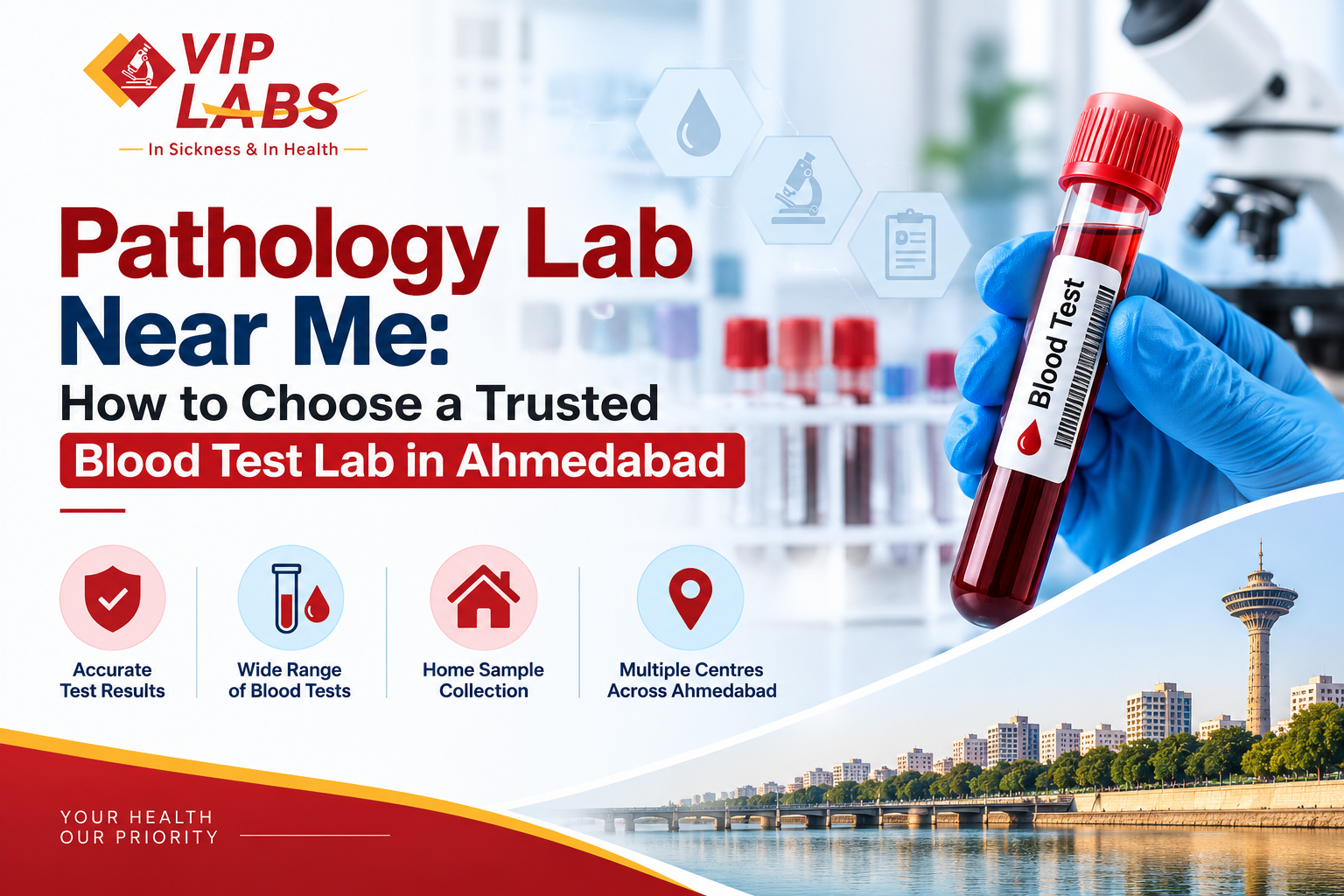 Pathology Lab Near Me: How to Choose a Trusted Blood Test Lab in Ahmedabad